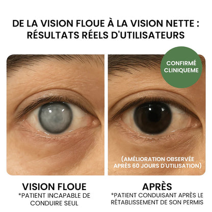 Vision Master - Acheter 1